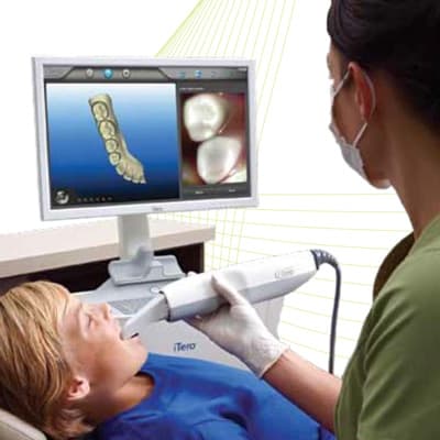 Itero scanner used on a young male patient.